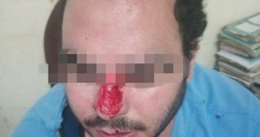 ننشر صورة الطبيب المعتدى عليه من أهل مريض طوارئ جامعة طنطا