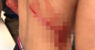 بعد القبض على المتهمين.. تفاصيل الاعتداء على لاعب نادى سبورتنج بالإسكندرية