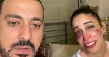 بفيديو ساخر وكدمات بالوجه.. دياب يستعين بزوجته للرد على دوره فى فرصة تانية