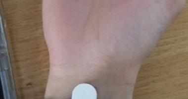 علماء يطورون ساعة يد لمرضى متلازمة توريت تصعق مستخدمها للتحكم فى تشنجاته