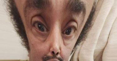 سليمان عيد ساخرا من صورة كوميدية له: "أنا كبرت دماغى"