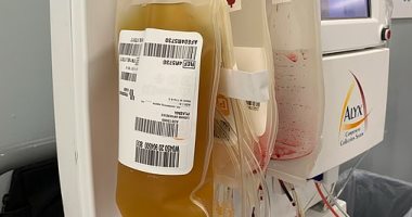 الصحة العراقية: علاج 15 ألف مصاب بفيروس كورونا بالبلازما منذ بدء الجائحة