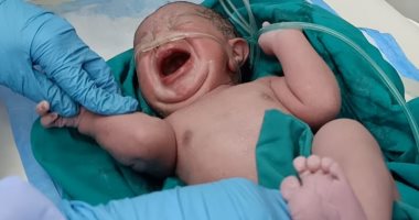  الطفل مصطفى المولود رقم 12 فى الحجر الصحى بمستشفى إسنا جنوب الأقصر