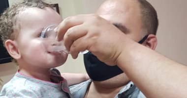فريق طبى بالإسكندرية ينجح فى زراعة قولون لطفلة 7 شهور ولدت بدون مرىء
