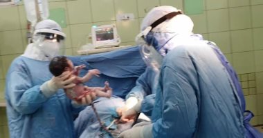 صور.. إجراء عمليتى ولادة قيصرية لسيدتين مصابين بكورونا بمستشفى الحجر بالبحيرة