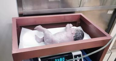 ولادة الطفل الثانى من جنين متجمد بعد ولادة توأمه بـ 10 سنين  