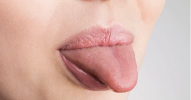 اعرف مرضك من لون لسانك