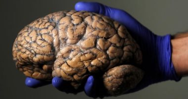 تلف الدماغ الخفى كابوس يهدد المتعافين من كورونا.. مشاكل عصبية قد تصيب ذوى الأعراض الخفيفة.. الهذيان والهلاوس والسكتات الدماغية الأبرز.. ومخاوف من تكرار سيناريو إنفلونزا 1918 وانتشار التهاب الدماغ الكسولة