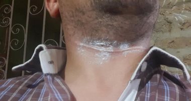 صور.. العناية الإلهية تنقذ شاب أقصرى من الموت خنقا بخيوط طائرة ورقية 
