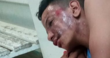 الحكومة تستجيب لاستغاثة أب لإنقاذ نجله وتوجه بإجراء عملية له على نفقة الدولة