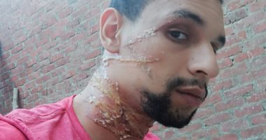 نجاة قائد موتوسيكل من الموت التفت حول رقبته حبال طائرة ورقية بالجيزة . صور