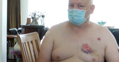 صورة.. رجل يهاجم مُعاق "بعضة عنيفة" فى صدره بسبب الكمامة ببلجيكا