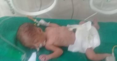 قارئ يناشد الصحة مساعدته فى تكاليف حضانة وأدوية لأولاده التوأم حديثى الولادة