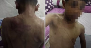 نيابة المحلة تستمع لشهود واقعة تعذيب طفل بسبب طائرة ورقية.. ويؤكدون صحتها