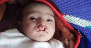 سيبها علينا.. عامل بالشرقية: نفسى أعمل عملية لنجلى الرضيع