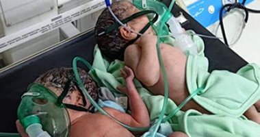 مصابة بكورونا تنجب 3 توائم بمستشفى ناصر فى بنى سويف.. صور