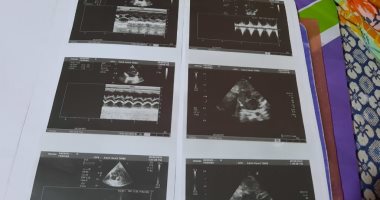 قارئ يناشد الصحة مساعدته لإجراء عملية تحويل مسار لابنه المريض