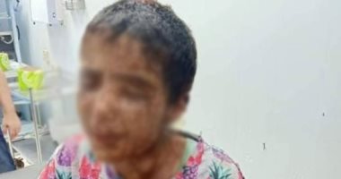 أسرة الطفلة ضحية التعذيب: لجنة من التضامن زارت أمنية وقدمت الدعم لها
