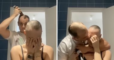 شاب يفاجئ حبيبته المصابة بالثعلبة بحلق شعره تضامنا معها