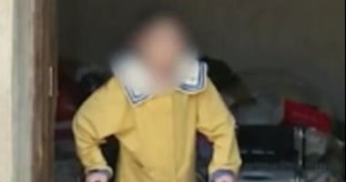 "فتاة قابلة للطى".. تمشى منتصبة بعد خضوعها لـ4 عمليات جراحية.. صور وفيديو