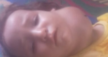 والد الطفلة "جنا" يستغيث بوزارة الصحة لإنقاذ حياة ابنته