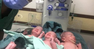 مستشفيات الأقصر تسجل 5 حالات ولادة نادرة فى أسبوعين.. أبرزها طفل بعين واحدة تكررت 6 مرات فقط على مدار 5 قرون.. وإجراء جراحة قيصرية لسيدة تحمل رحمين فى حالة تحدث مرة لكل 500 مليون سيدة فى العالم.. صور