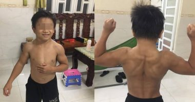 صبى 10 سنوات يذهل الإنترنت بعضلاته.. وأطباء: لديه متلازمة سوبر مان