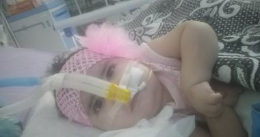 صور.. الطفلة "مليكه" تحتاج لعلاج بـ4 ملايين جنيه لإنقاذها من الموت