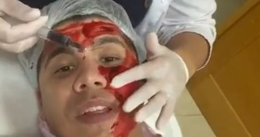 تنظيف بشرة وحقن بلازما لـ حسن شاكوش وعمر كمال فى تونس.. فيديو
