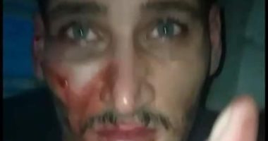ننشر صور المتهمين بالاتجار فى الأعضاء البشرية بالإسماعيلية