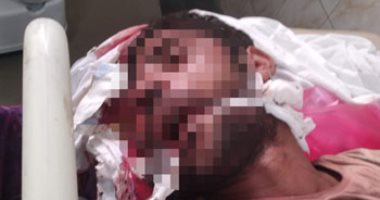 مصرع شخص فى مشاجرة شرق الإسكندرية
