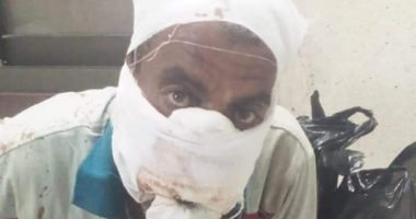 ضبط 2 وهروب 4 آخرين متهمين بقطع أنف عمهم بسبب الميراث بالمحلة