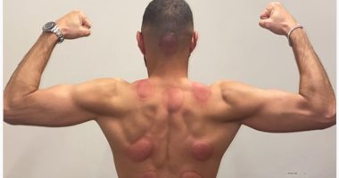  انستجرام نجوم الكرة.. بنزيما يستعد للموسم الجديد بالحجامة