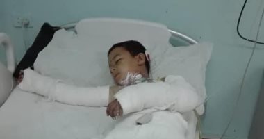 "تنمروا عليه أشعلوا النار بجسده".. تفاصيل وفاة طفل بحروق نارية فى المنوفية