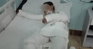 3 أطفال يحرقون صديقهم 9 سنوات حيًا بالمنوفية.. ووالد الضحية: التنمر السبب
