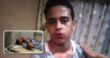 اتكتب له عمر جديد.. طفل ينجو من الموت فى بولاق الدكرور بسبب "الكيف".. تاجر مخدرات وشقيقه يضربان طالبا بزجاجة فى وجهه.. الشرطة تحدد هوية المتهمين وتكثف جهودها لضبطهما.. ووالد الضحية يطالب بتعديل قانون الطفل..صور