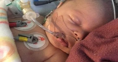 قطرة لبن تسبب فى 3 نوبات قلبية خطيرة لرضيع بعمر 17 يوما.. صور