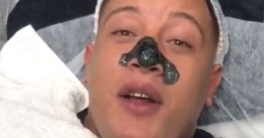 من أحمد سعد لـ حمو بيكا.. ركوب التريند بعمليات التجميل وتنظيف البشرة
