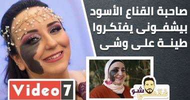 الوحمة رزق ونعمة.. شروق تروى مواقف التنمر منذ الطفولة  