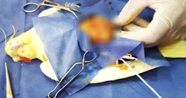 استئصال ورم كبير لطائر زينة بطب بيطرى جامعة المنصورة.. صور