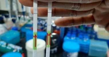 شركة بريطانية تقدم 10 أجسام مضادة خاصة بـ فيروس كورونا قد تساعد في اللقاحات