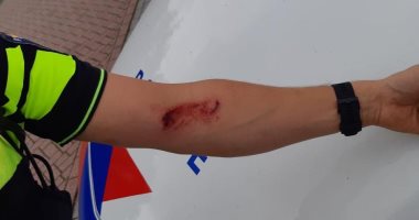 متهم يعض ذراع شرطى هولندى أثناء القبض عليه فى مدينة ألميلو.. صور