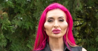 بسبب عمليات التجميل.. عارضة أزياء أوكرانية تحظى بــ"أكبر خدين فى العالم".. صور