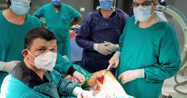 إنقاذ مريض من بتر ساقه المصابة بـ"الغرغرينا" بمستشفى طنطا التعليمى