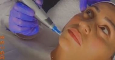 حقيقة خضوع دينا الشربينى لعملية تجميل .. اعرف الحكاية