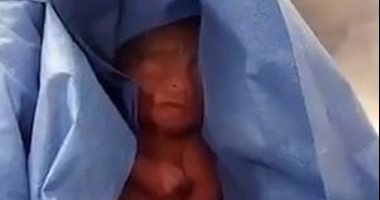 طفل مكسيكي يظل فى المشرحة 6 ساعات ظنا بأنه توفى .. صور  
