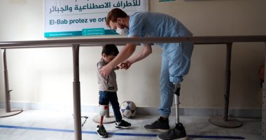قصة سورى عمل بمركز أطراف صناعية لتأهيل المصابين بعد بتر قدمه فى الحرب.. صور