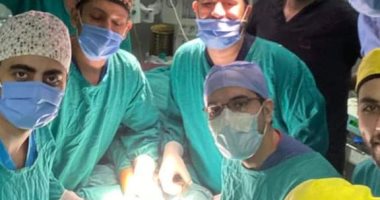 تقويم اعوجاج ساقي طفل منعه من المشي 4 سنوات في جراحة نادرة بمستشفي طنطا التعليمى