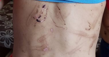 تعرف على حقيقة ضرب أب لابنه بسلك كهرباء فى الشرقية