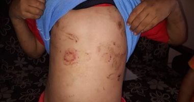 زوج أم الطفلين المتعدى عليهما بقليوب: كانوا دايما بيخرجوا من غير إذن